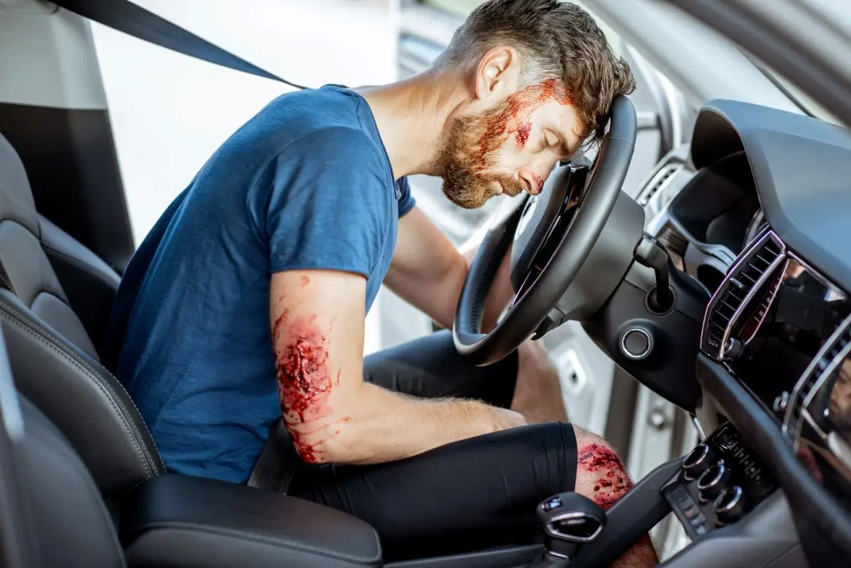 Injured driver leaning on the steering wheel after a serious car accident, with visible cuts and bruises.